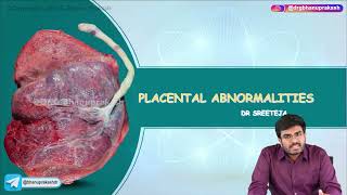 Placental Abnormalities  Obstetrics and Gynaecology Lecture [upl. by Nnaxor]