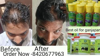 New Regrowth Hair Oil ampNeo Hair Paste For Alopecia and Stopped Hair Fall [upl. by Eustacia]