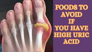 7 foods you need to avoid if you have high uric acid miss healthy [upl. by Hutchison586]