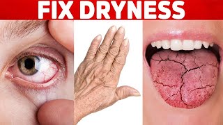 The BEST Remedies for Dry Skin Eyes and Mouth [upl. by Hnah271]