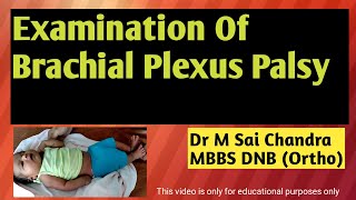 Examination of Brachial Plexus Palsy [upl. by Nah]