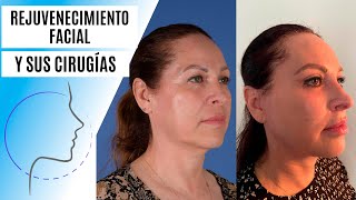 Rejuvenecimiento facial ¿qué procedimientos necesito yo [upl. by Wardle]