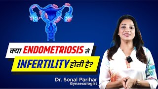 Endometriosis amp Infertility  Medicine ya surgery  Kya better option Hai  Sonal Parihar [upl. by Thevenot]