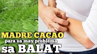 Kakawate o Madre Cacao Gamot sa Ibat ibang Karamdaman [upl. by Concettina]