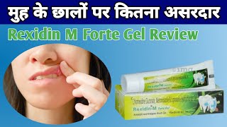 Rexidine M Forte Gel For Oral Mouth Ulcer  Uses Benefits And SideEffects [upl. by Eniarda]