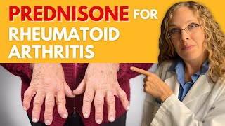 Managing Rheumatoid Arthritis with Prednisone Dosage Effectiveness and Side Effects [upl. by Swetiana467]