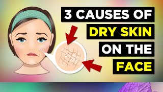 3 Causes Of Dry Skin On The Face Dry Skin Remedies [upl. by Lexine418]