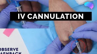 Intravenous IV cannulation  OSCE Guide  UKMLA  CPSA [upl. by Nosrettap328]