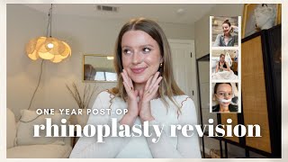 Rhinoplasty Revision Surgery OneYear PostOp Recap  Recovery Healing The Process  Tips [upl. by Adelric]