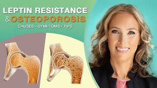 Leptin Resistance  Osteoporosis amp Leptin Resistance  Dr J9 Live [upl. by Laktasic]