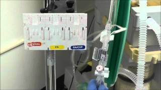 How to Setup an Arterial Line Transducer [upl. by Ecnaiva]