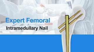 CZMEDITECHExpert Femoral Intramedullary Nail Orthopedics implants intramedullary nail [upl. by Aivle95]