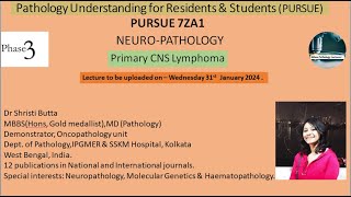 Pursue 7 Z A1 Primary CNS Lymphoma [upl. by Wrigley]