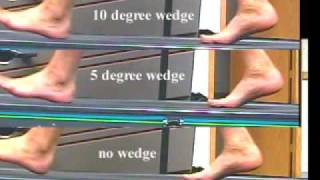 treadmill study on the effect of the Cluffy Wedge [upl. by Hannaoj]