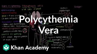 What is polycythemia vera  Hematologic System Diseases  NCLEXRN  Khan Academy [upl. by Hembree]