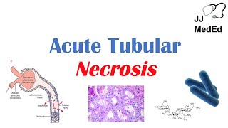 Acute Tubular Necrosis ATN  Symptoms Causes and Treatments [upl. by Eibloc342]