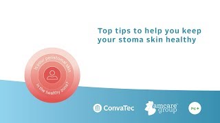 Top tips for maintaining healthy peristomal skin [upl. by Coveney]