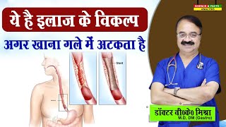 ये है इलाज के विकल्प अगर खाना गले में अटकता है  DYSPHAGEA DIFFICULTY IN SWALLOWING TREATMENT [upl. by Ehsiom]