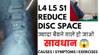 L4L5 and L5S1 reduced disc space exercises in Hindi  Disc space narrowing L5S1 treatment [upl. by Relda]