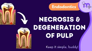 Pulp Degeneration amp Necrosis  Types  Management  Endodontics  Animated Explanation [upl. by Tibbs]