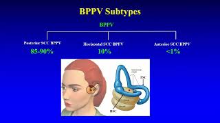 BPPV  Preliminary Insights [upl. by Derrej]