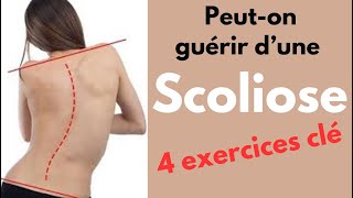 4 Exercices Clés Anti Scoliose [upl. by Rockie]