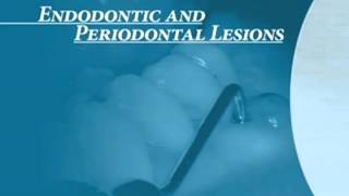 Endodontics Torabinejad 60 Endo Perio Introduction [upl. by Kelby]