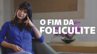 3 dicas infalíveis para evitar a foliculite  Viver Bem [upl. by Mcconnell]