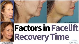 How Facelift Recovery can be Faster Without Compromising Results or Longevity [upl. by Assirat194]