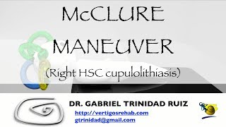 McCLURE MANEUVER RIGHT HSC CUPULOLITHIASIS [upl. by Doreen]