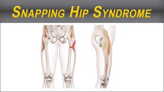 Get Rid of Snapping Hip Syndrome  Iliotibial Band Tightness  Strength and Stretch for Relief [upl. by Zinck]