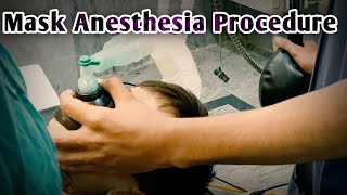 Mask anesthesia Procedure  Small Baby Boy Going Under General Anesthesia  Anesthetic Waseem [upl. by Laban669]