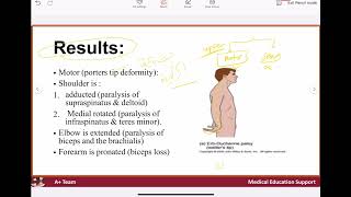 Brachial plexus injury [upl. by Wolk478]