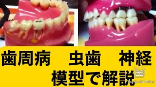 歯周病と虫歯 歯が痛い 腫れた歯茎 歯ぐき膿 しみる 奥歯 歯が浮く説明動画 １０ 大宮鈴木歯科医院 歯医者デンタル歯科クリニック [upl. by Onitnerolf]