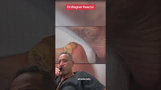 INCISION amp DRAINAGE OF HUGE HEEL ABSCESS🤯shorts [upl. by Alard741]