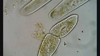 Paramecium Dividing [upl. by Kir849]