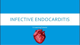 Infective Endocarditis [upl. by Cross354]