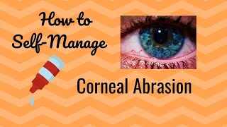 How to Treat Your Corneal Abrasion at Home [upl. by Adams]