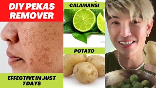 DIY PEKAS REMOVER Effective in just 7 Days [upl. by Slerahc]