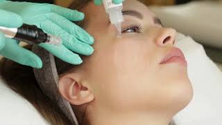 Facial Fillers Laser Treatment at Hlccs RanchiCall now 9334334935 9431529553 fillers beauty [upl. by Dickens]