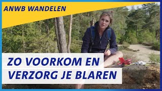 Blaren voorkomen Hoe voorkom genees en behandel je blaren  ANWB Wandelen [upl. by Tenaj]