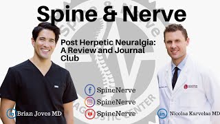 Post Herpetic Neuralgia A Review and Journal Club [upl. by Gnni856]