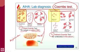 Hematology  2  U1L11  Coombs test [upl. by Kuo]