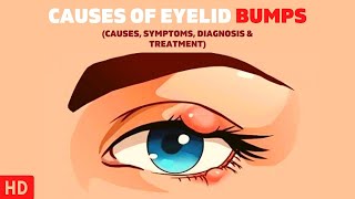 The Surprising Causes of Eyelid Bumps You Never Knew About [upl. by Emilia]