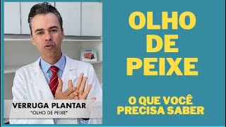 Olho de peixe [upl. by Dennis]