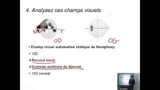 Dossier PAE Ophtalmologie 02 [upl. by Rexfourd]