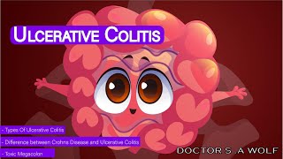 Ulcerative colitis  causessymptomsdiagnosistreatmentpathology [upl. by Kermit]