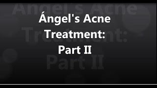 Ángels Acne Treatment 2 [upl. by Entroc939]