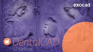 DentalCAD 32 Elefsina software release highlights [upl. by Noinatrad]