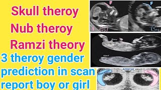 Ramzi theory Skull theroy Nub theroy gender reveal full details in tamil [upl. by Ladew735]